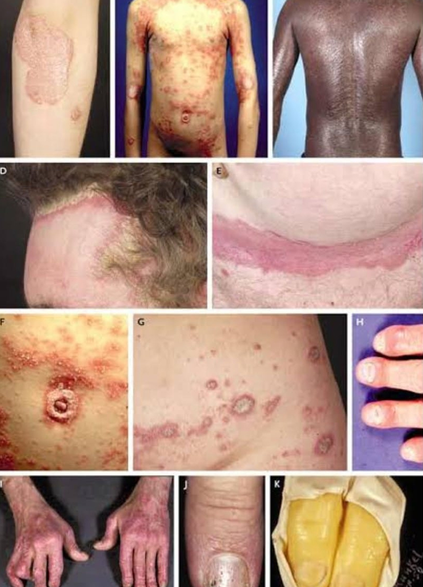 Skin Problem
